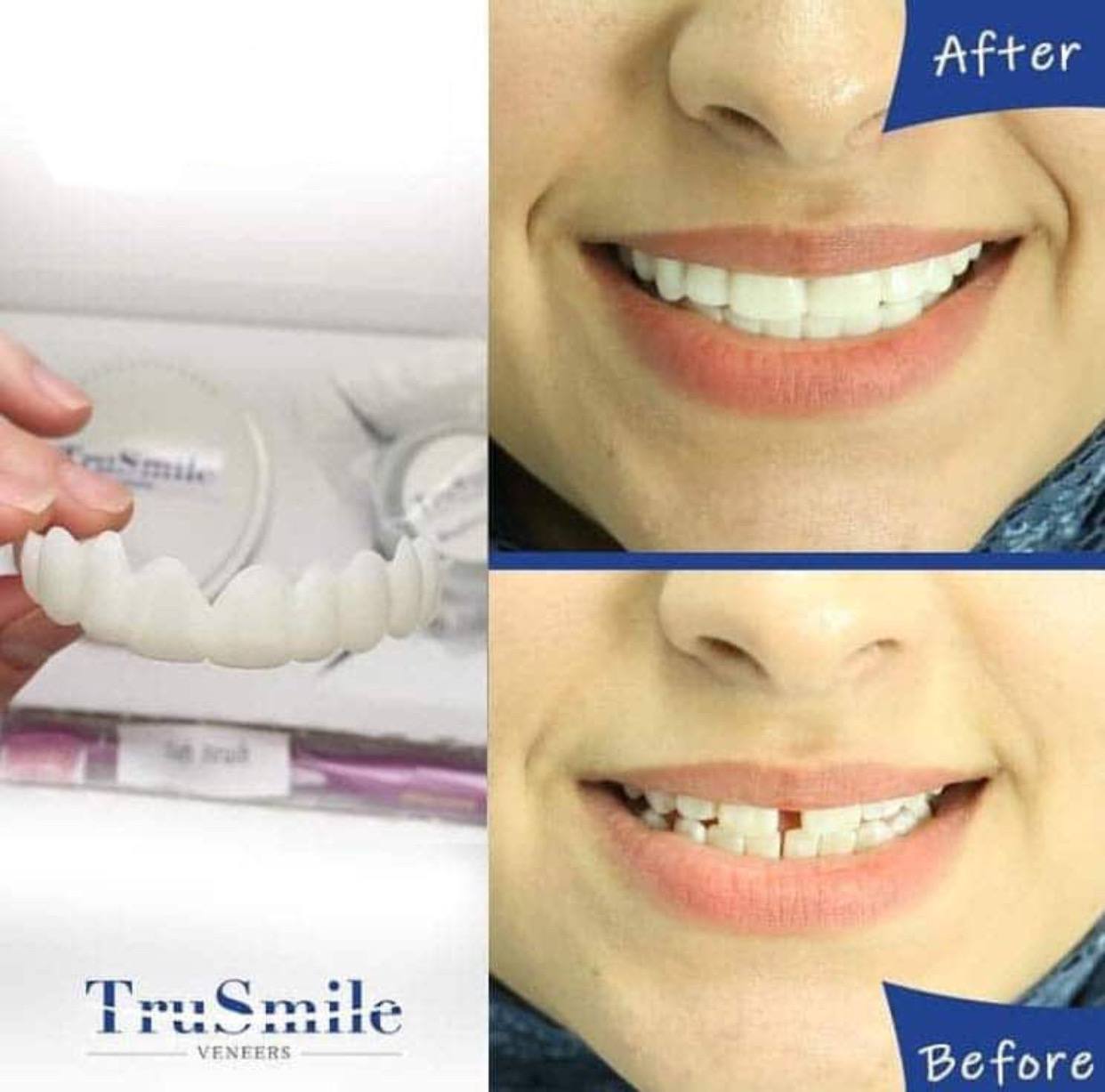 لمینت متحرک شرکتی دو فک اصلی